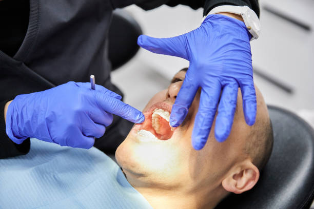 Best Urgent Care for Lost Fillings or Crowns in Vinita Park, MO